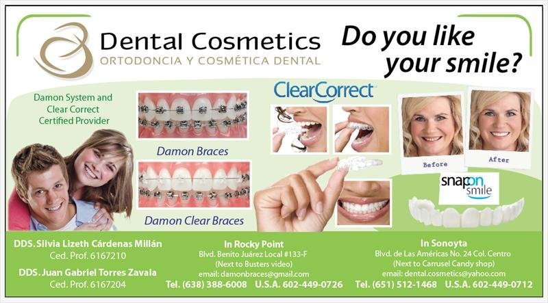 dental cosmetics