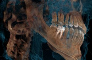 3d Dental X-Ray