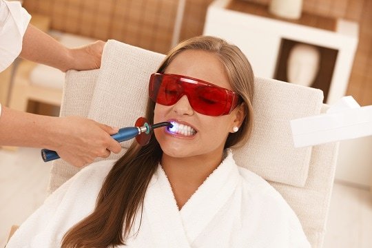 laser teeth whitening