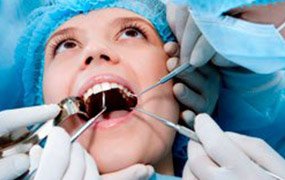 surgical extractions